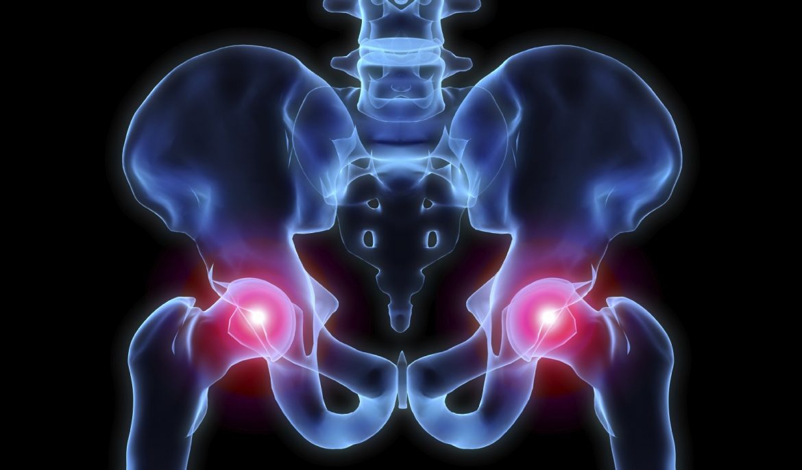hip pain treatments Xcell Medical Elyria