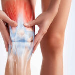 meniscus knee partial tear