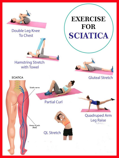 Sciatica pain causes, symptoms and fast relief with exercises