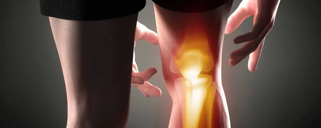 knee-pain-treatments
