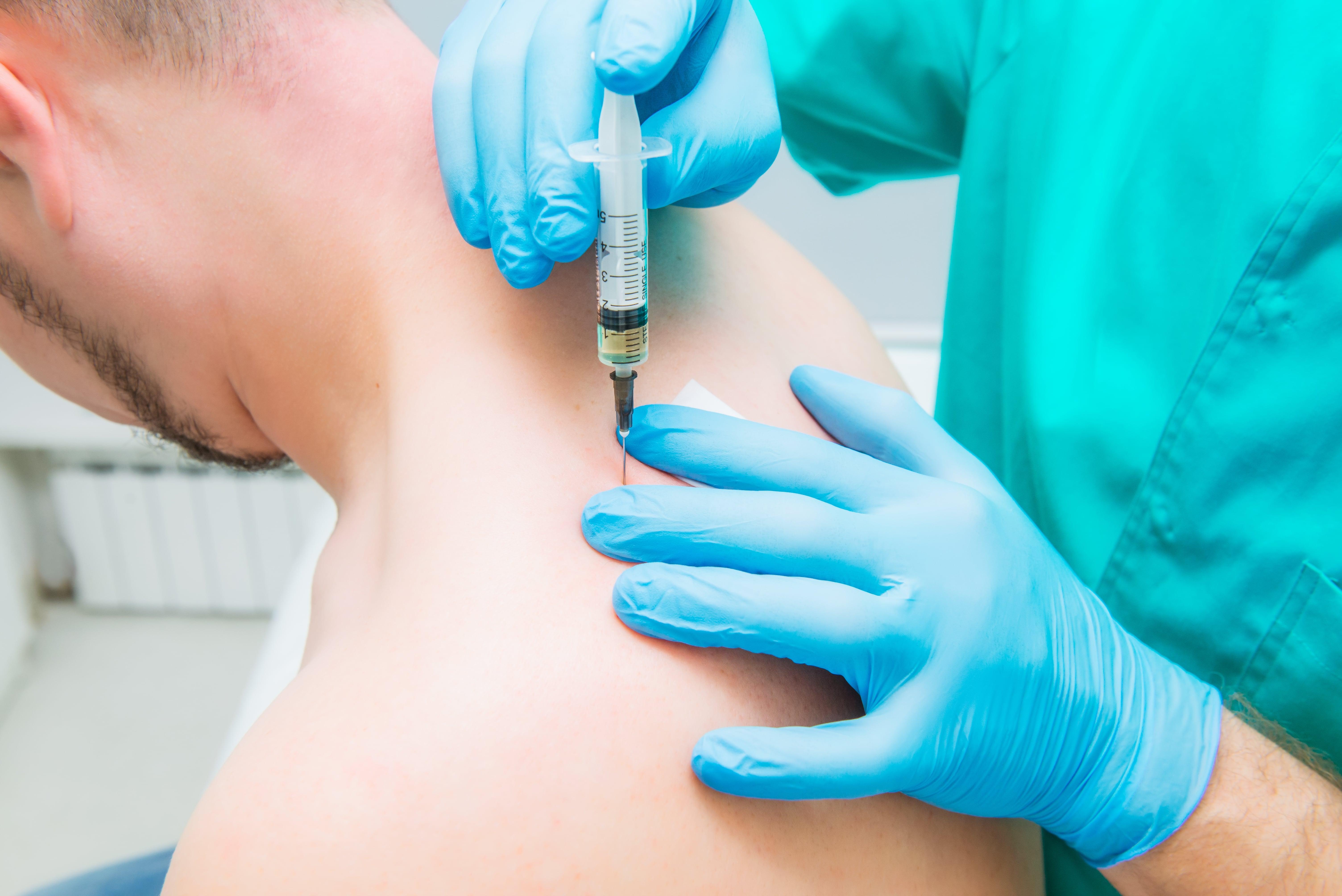 trigger point injections with botox