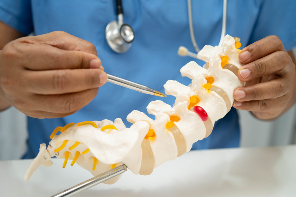 herniated disc